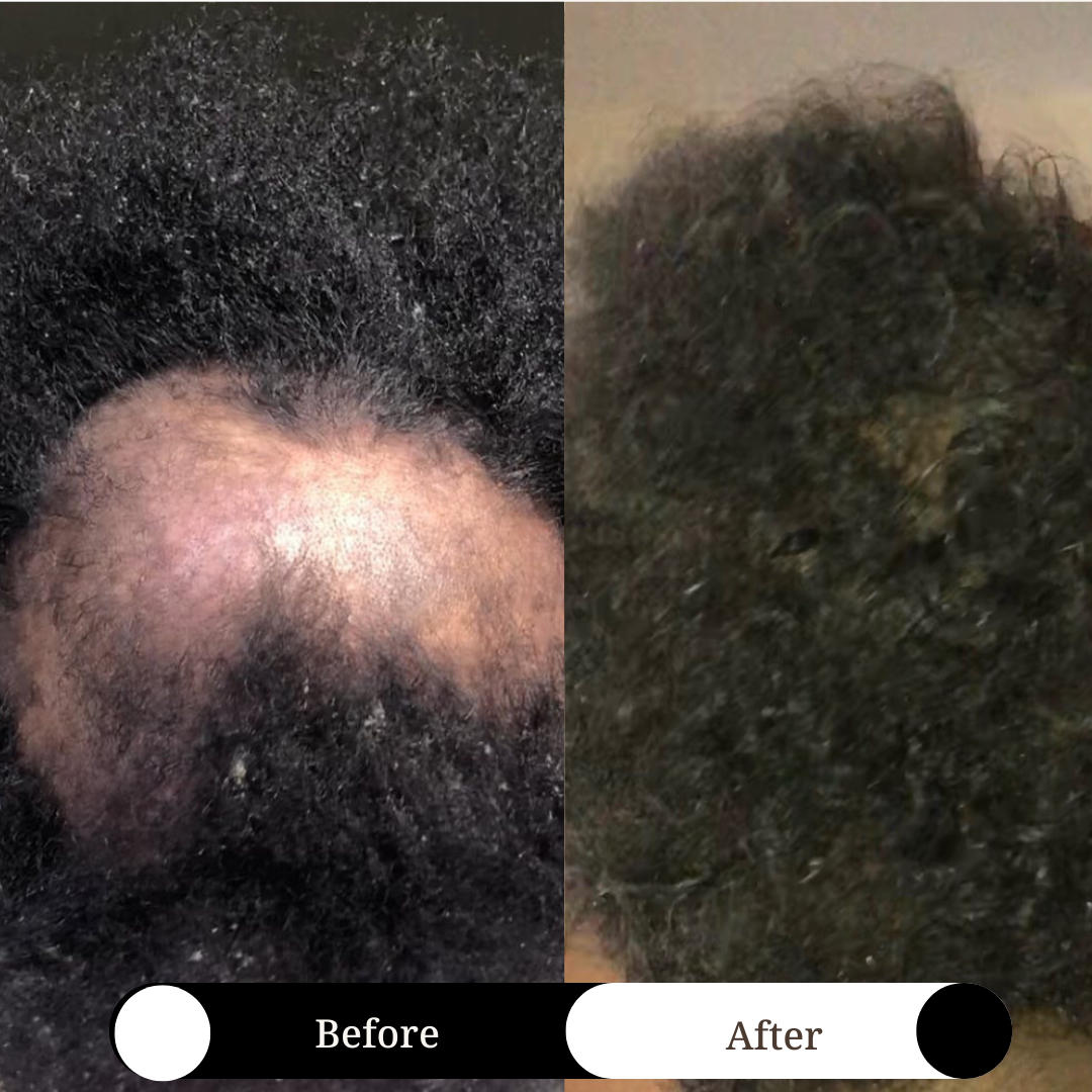 Holistic Intense Hair Loss Prevention & Repair Set