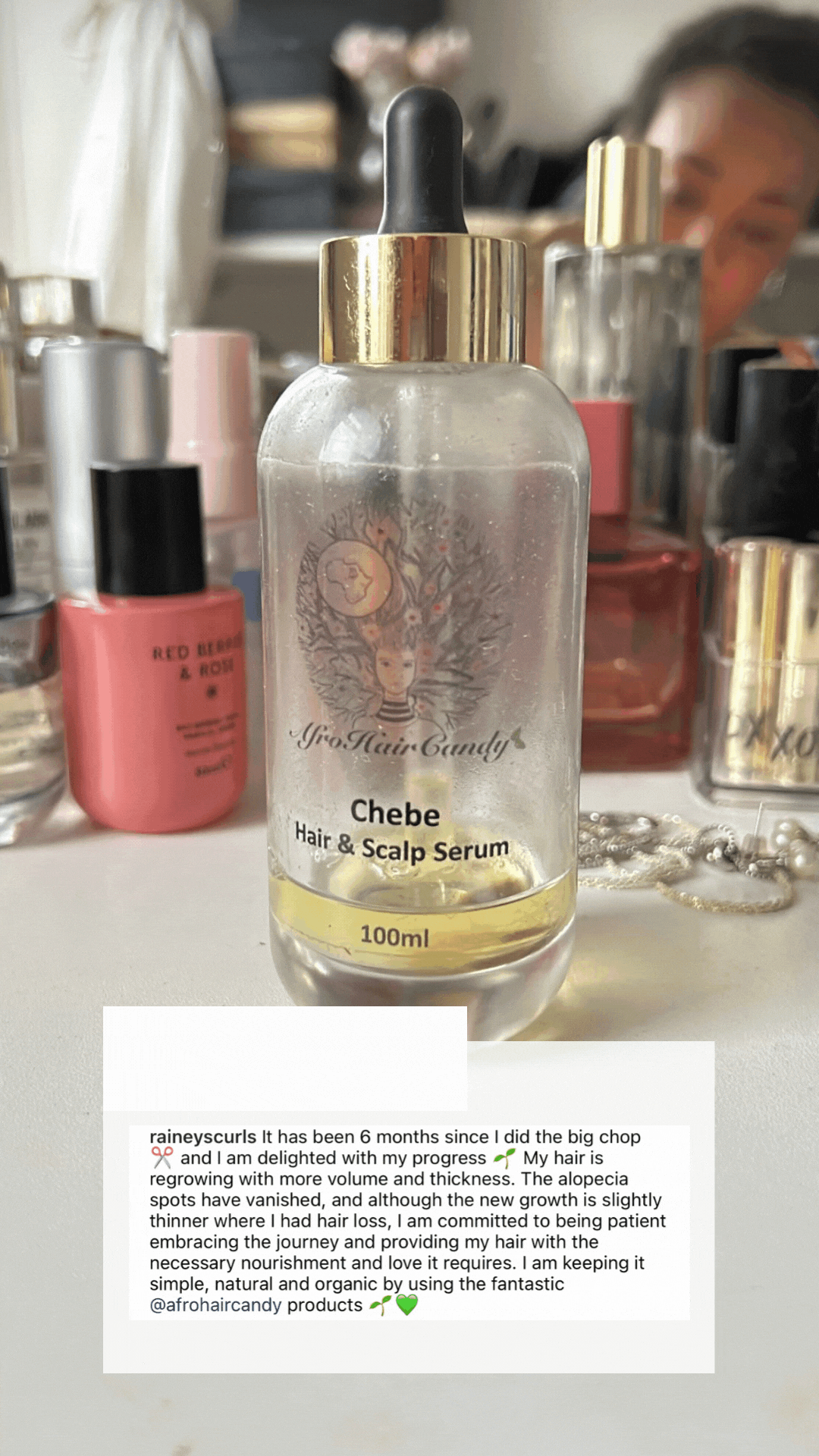 Holistic Intense Hair Loss Prevention & Repair Set - AfroHairCandy