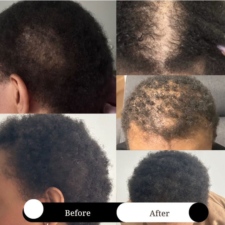 Holistic Intense Hair Loss Prevention & Repair Set