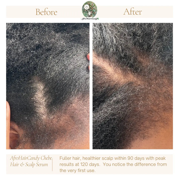 https://afrohaircandy.co.uk/products/chebe-hair-and-scalp-serum