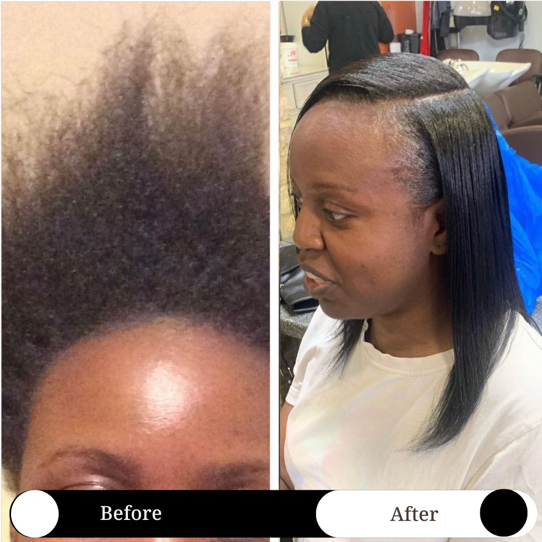 Hair Growth