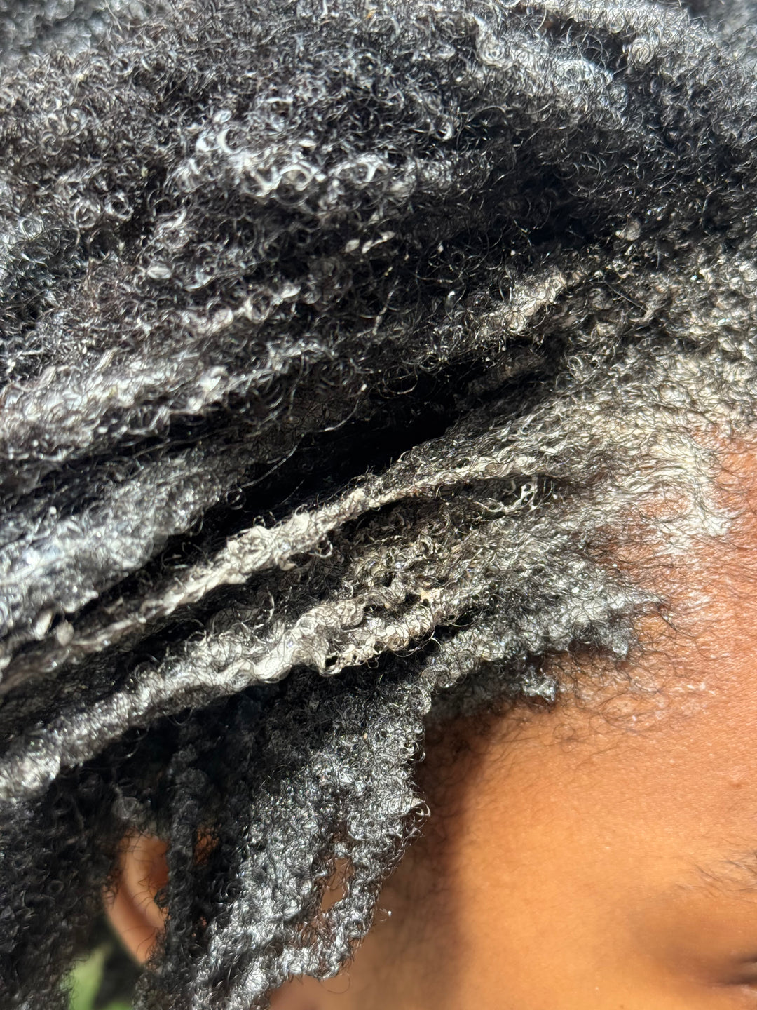 Follicle Reset™ Clarifying Hair & Scalp Soap