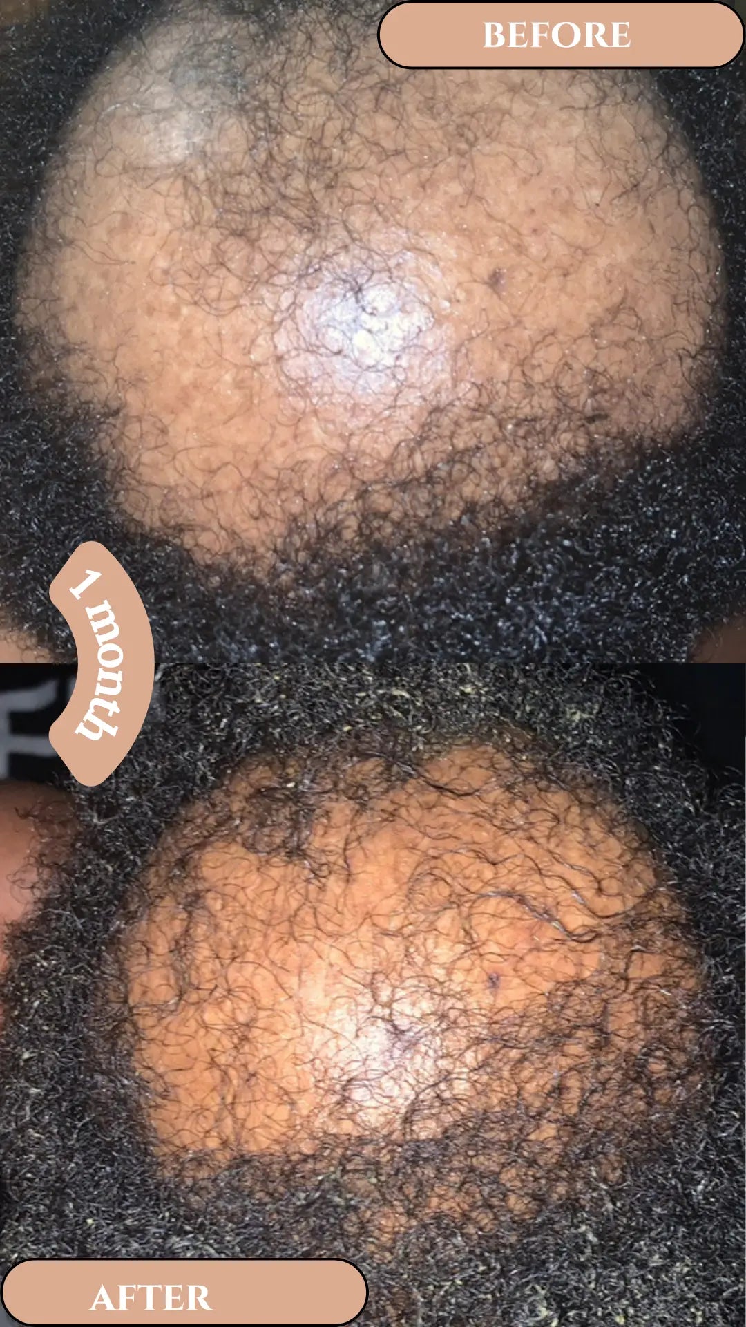 Holistic Intense Hair Loss Prevention & Repair Set - AfroHairCandy