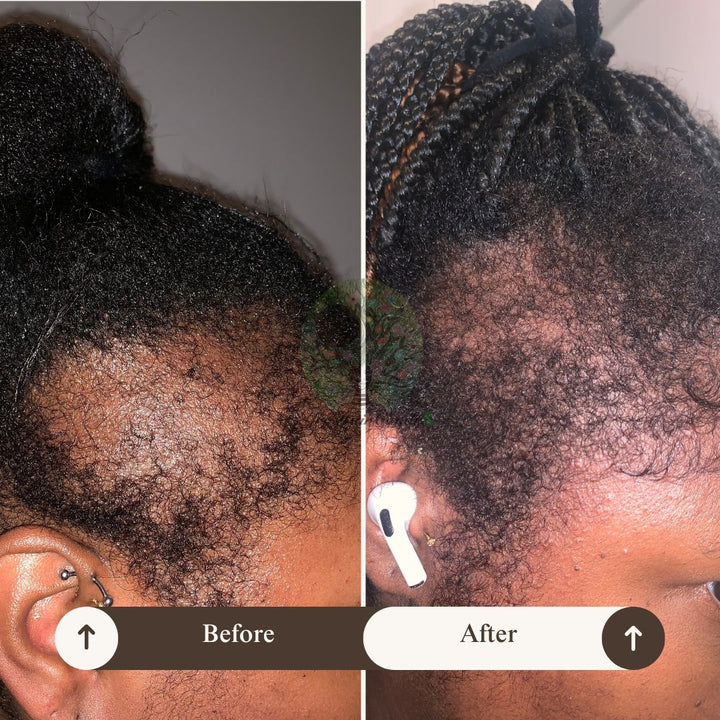 Repair, Restore, Reclaim: Your Hair Growth Journey Master Class