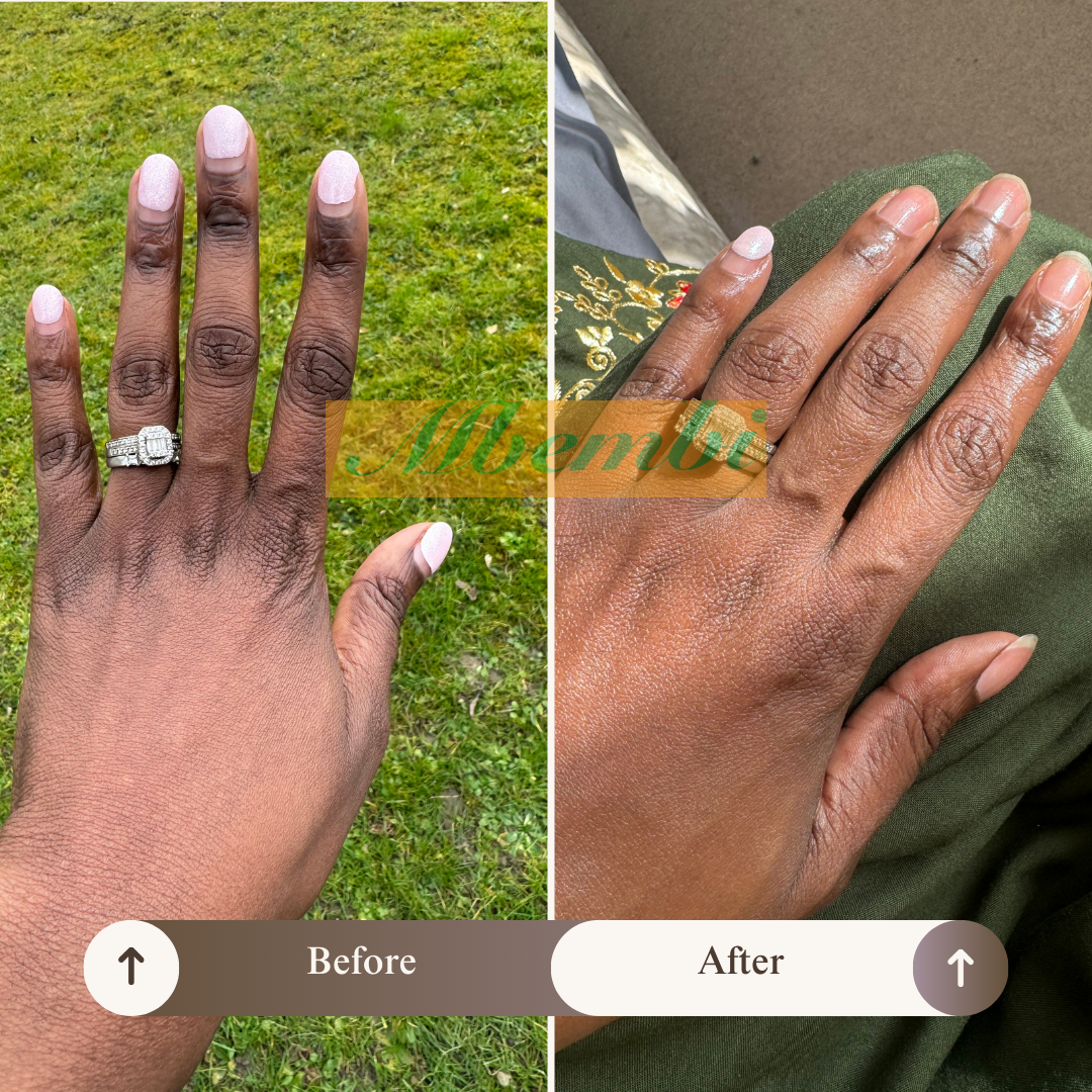 Rejuvenating Hand Treatment