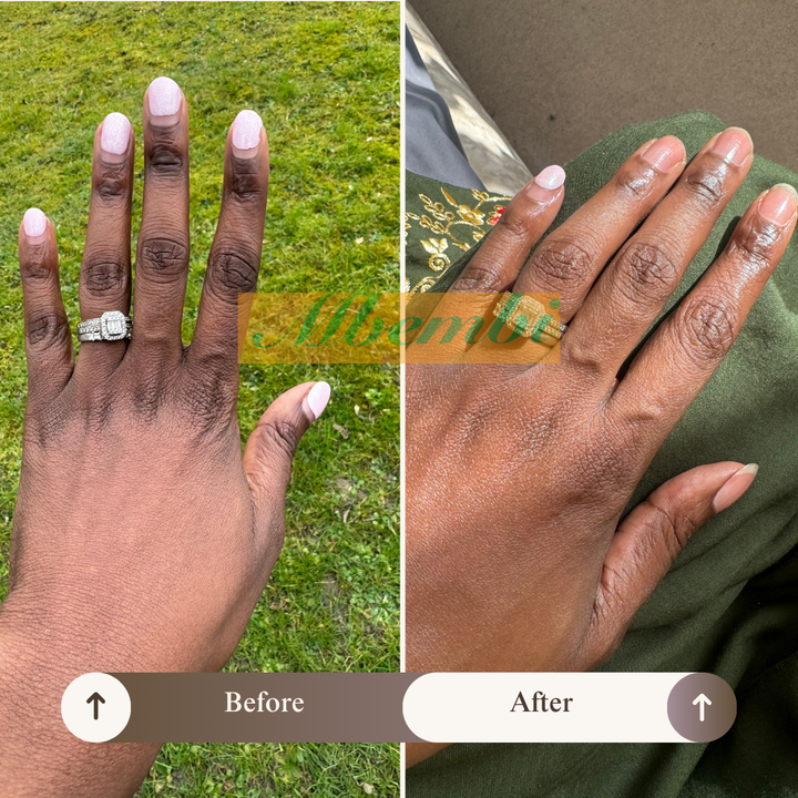 Rejuvenating Hand Treatment